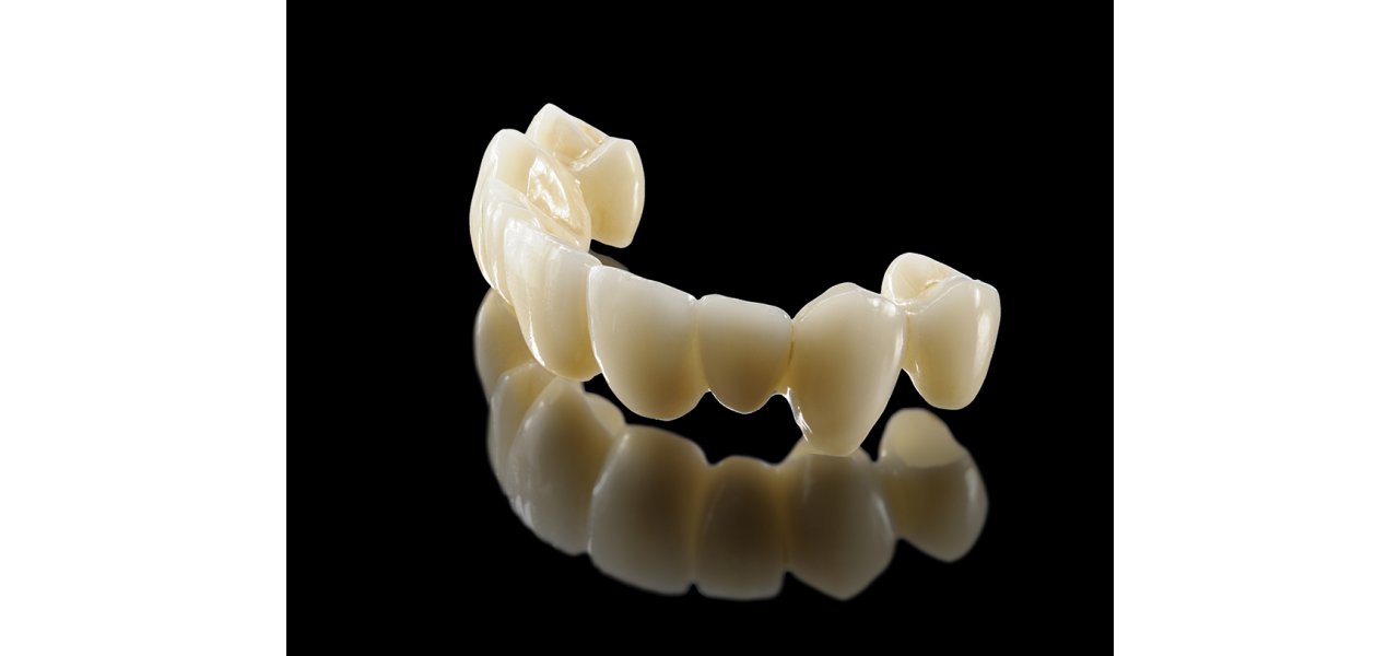 Zirconium unterstützt Porzellan