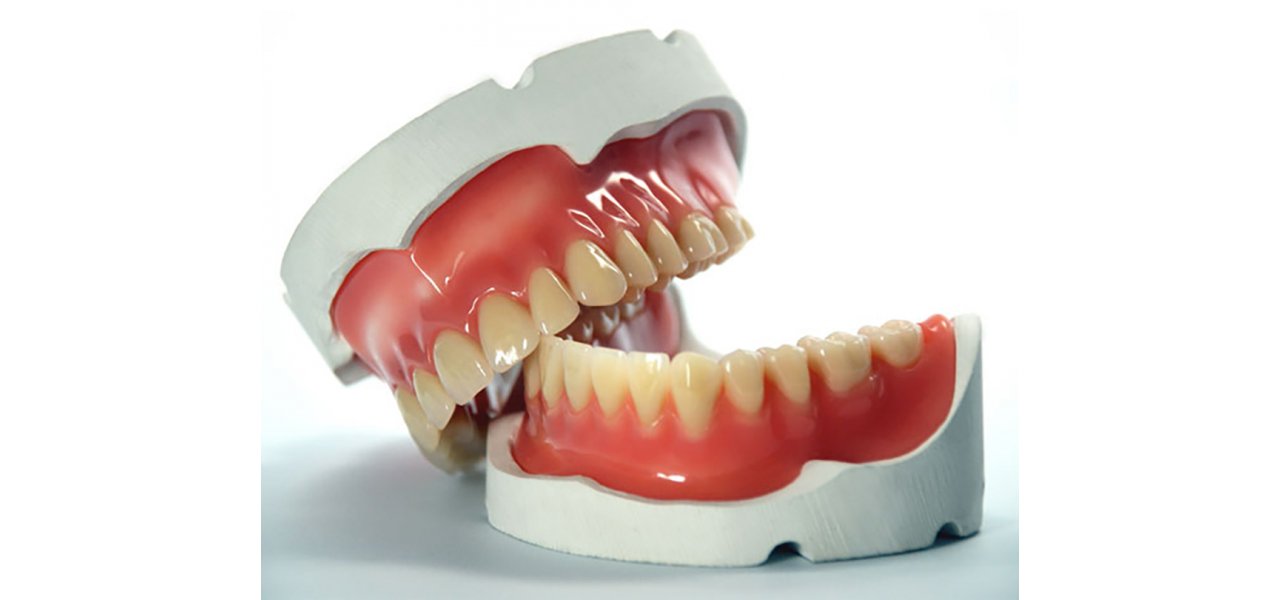 Prosthetic Treatment